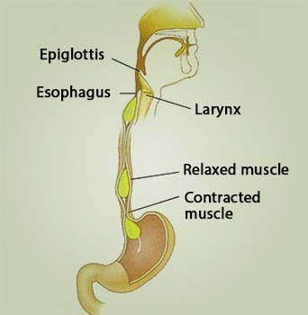 achalasia cardia introduction