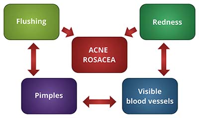 Symptoms of Acne Rosacea