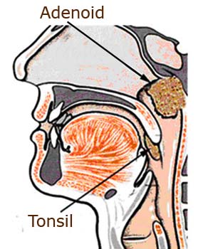 Adenoids_Introduction