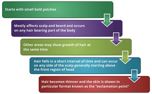 Symptoms of Alopecia Areata (Hair Loss)