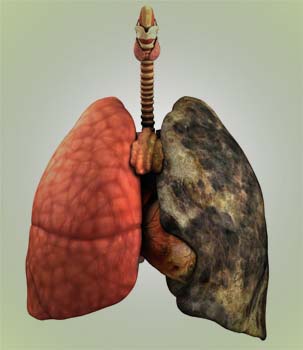 COPD summary