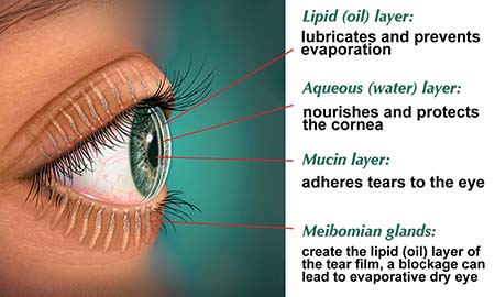 chalazion introduction