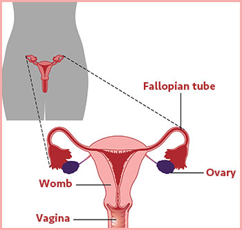 dysfunctional uterine bleeding Introduction