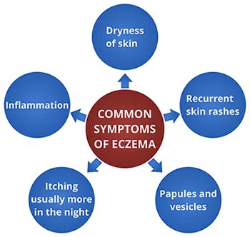 Symptoms of Eczema 2