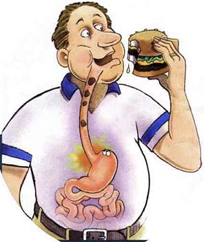 GERD (Gastro-esophageal reflux disease) - WelcomeCure