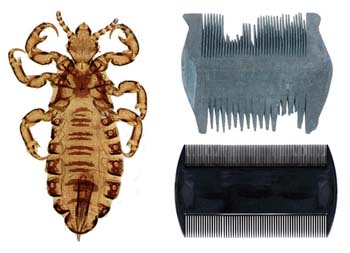 Do's and Don'ts of Head Lice