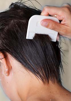 Treatment of Head Lice