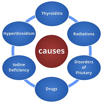 Causes of Hypothyroidism