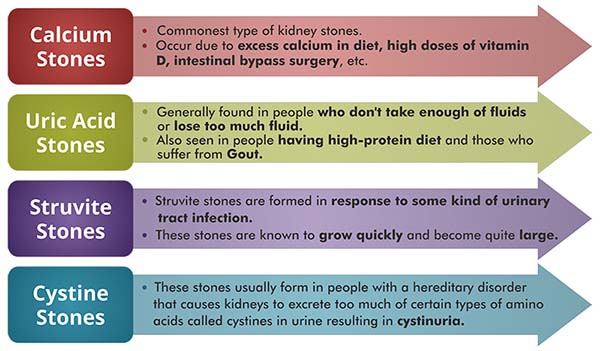 Types of Kidney Stones