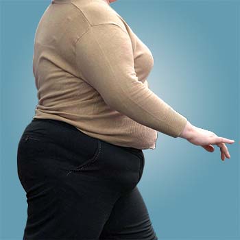 Prevention of Obesity