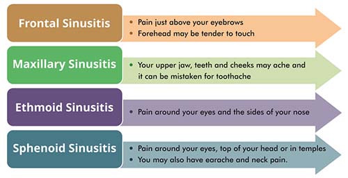 Symptoms of Sinusitis