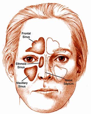 Introduction of Sinusitis