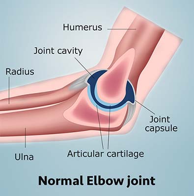 Definition of Tennis Elbow