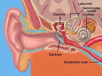 Tinnitus Introduction