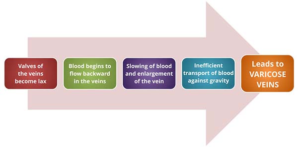 Definition of Varicose Veins