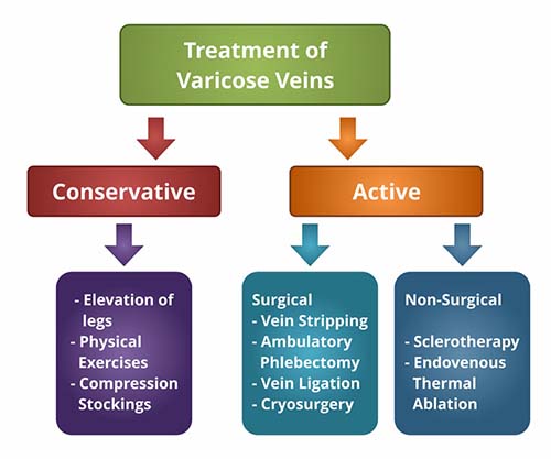 Varicose Veins Treatment