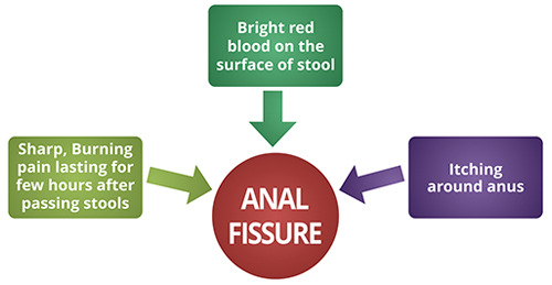anal abrasions of Causes
