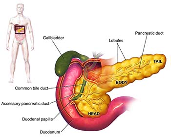 diabetes causes