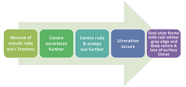 introduction of oral ulcers