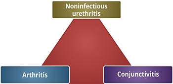 Sciatica Similar Conditions