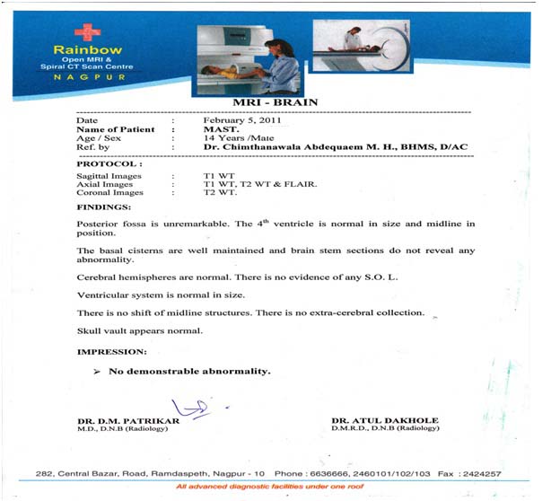 After Treatment for Glioma