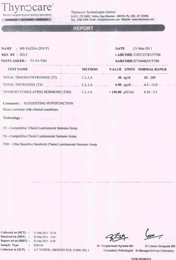 Hypothyroidism treatment