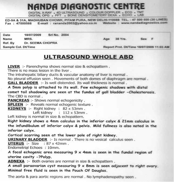 Before Treatment Ovarian cyst Img